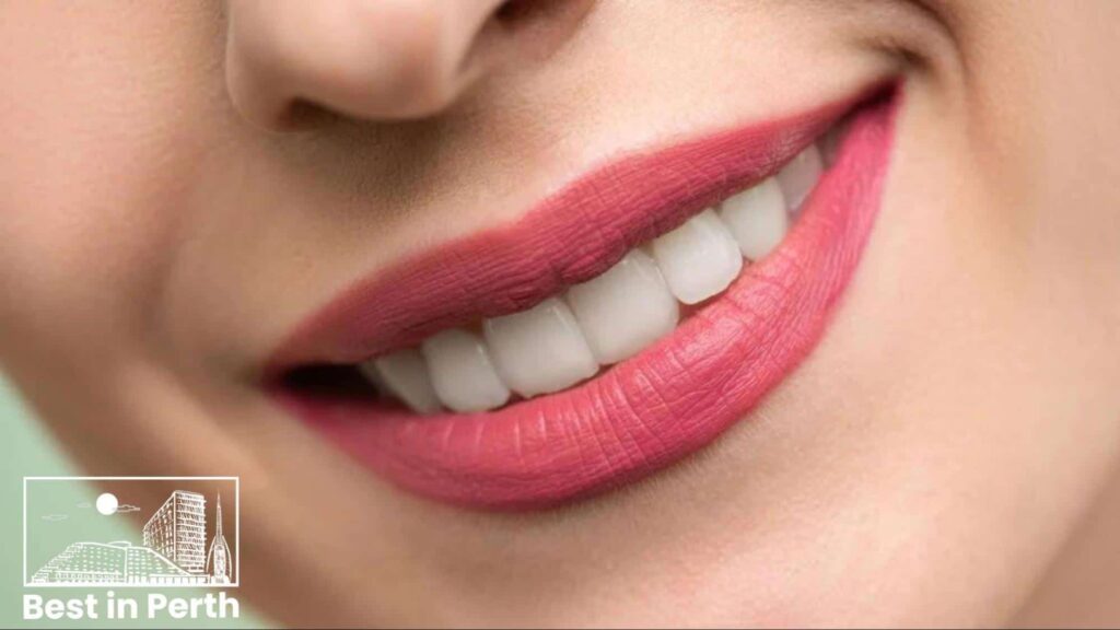 5 Best Cosmetic Dentistry Clinics in Perth